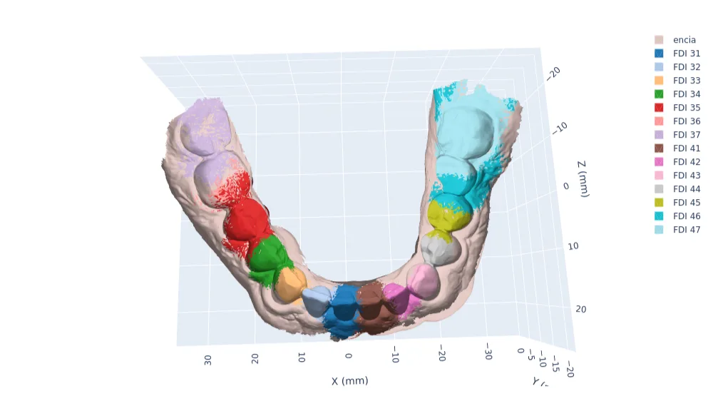 A 3D scan of a lower dental arch, each tooth segmented in its own colour and labelled with its FDI code, with the gingiva left in pink.